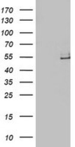LPL Mouse anti-Human, Clone: OTI6A10, lyophilized, TrueMAB 100 &mu;g; Unconjugated:Antibodies,