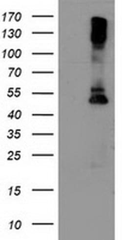 LPL Monoclonal Antibody (OTI3A10), TrueMAB , OriGene 100 &mu;L; Unconjugated:Antibodies,