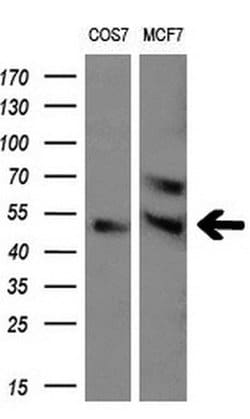 LPL Monoclonal Antibody (OTI3A10), TrueMAB , OriGene 100 &mu;L; Unconjugated:Antibodies,