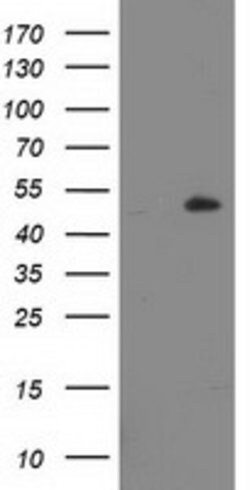 LPL Mouse anti-Human, Clone: OTI4G2, lyophilized, TrueMAB 100 &mu;g; Unconjugated:Antibodies,