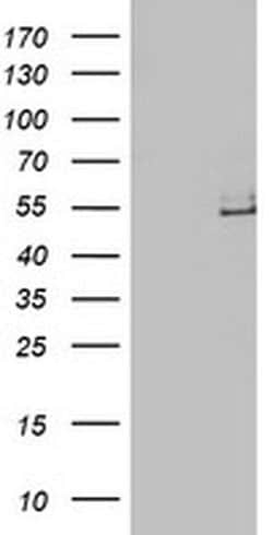 LPL Monoclonal Antibody (OTI4G7), TrueMAB , OriGene 100 &mu;L; Unconjugated:Antibodies,