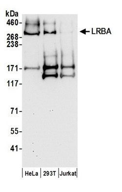 LRBA Rabbit anti-Human, Polyclonal, Bethyl Laboratories 100 &mu;L; Unconjugated:Antibodies,