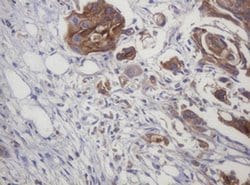 LRCH4 Monoclonal Antibody (OTI1F8), TrueMAB , OriGene:Antibodies:Primary
