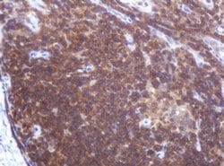 LRCH4 Monoclonal Antibody (OTI1F8), TrueMAB , OriGene 100 &mu;L; Unconjugated:Antibodies,