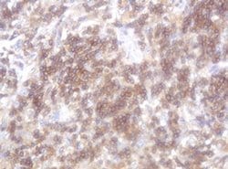 LRCH4 Monoclonal Antibody (OTI1F8), TrueMAB , OriGene 100 &mu;L; Unconjugated:Antibodies,