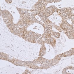 LRPPRC Rabbit anti-Human, Polyclonal, Bethyl Laboratories 100 &mu;L; Unconjugated:Antibodies,