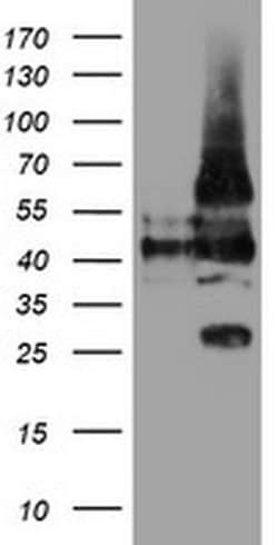 LRRC25 Monoclonal Antibody (OTI1D4), TrueMAB , OriGene 100 &mu;L; Unconjugated:Antibodies,