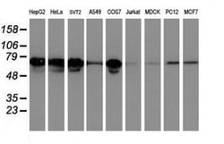 LRRC50 Monoclonal Antibody (OTI3F9), TrueMAB , OriGene:Anticuerpos:Anticuerpos