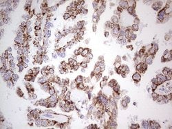 LRRC6 Mouse anti-Human, Clone: OTI2F8, lyophilized, TrueMAB 100 &mu;g;