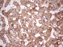 LRRC6 Mouse anti-Human, Clone: OTI2F8, lyophilized, TrueMAB 100 &mu;g;