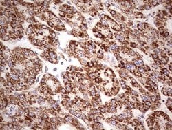 LRRC6 Mouse anti-Human, Clone: OTI2F8, lyophilized, TrueMAB 100 &mu;g;