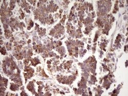 LRRC6 Monoclonal Antibody (OTI7E9), TrueMAB , OriGene 30 &mu;L; Unconjugated:Antibodies,