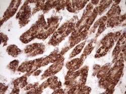 LRRC6 Monoclonal Antibody (OTI7E9), TrueMAB , OriGene:Antibodies:Primary