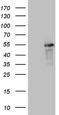 LRRC6 Monoclonal Antibody (OTI2E4), TrueMAB , OriGene 30 &mu;L; Unconjugated:Antibodies,