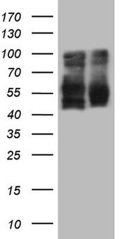 LRRTM1 Monoclonal Antibody (OTI5C3), TrueMAB , OriGene 100 &mu;L; Unconjugated:Antibodies,