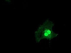 LSM1 Monoclonal Antibody (OTI5C6), TrueMAB , OriGene 30 &mu;L; Unconjugated:Antibodies,