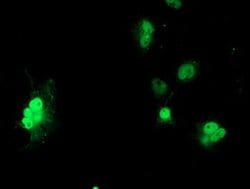 LSM1 Monoclonal Antibody (OTI5E6), TrueMAB , OriGene 100 &mu;L; Unconjugated:Antibodies,