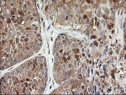 LSM1 Monoclonal Antibody (OTI5C6), TrueMAB , OriGene 30 &mu;L; Unconjugated:Antibodies,