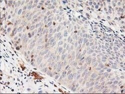 LSM1 Monoclonal Antibody (OTI5C6), TrueMAB , OriGene 30 &mu;L; Unconjugated:Antibodies,