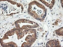 LSM1 Monoclonal Antibody (OTI5C6), TrueMAB , OriGene 30 &mu;L; Unconjugated:Antibodies,