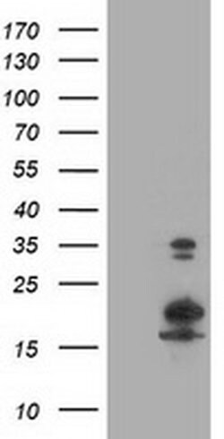 LSM1 Monoclonal Antibody (OTI5C6), TrueMAB , OriGene 30 &mu;L; Unconjugated:Antibodies,