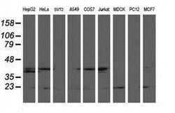 LSM1 Monoclonal Antibody (OTI5C6), TrueMAB , OriGene 30 &mu;L; Unconjugated:Antibodies,