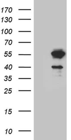 LSM11 Monoclonal Antibody (OTI1F1), TrueMAB , OriGene 30 &mu;L; Unconjugated:Antibodies,