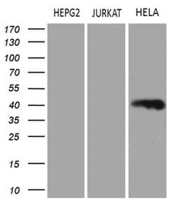 LSM11 Monoclonal Antibody (OTI1F1), TrueMAB , OriGene 30 &mu;L; Unconjugated:Antibodies,