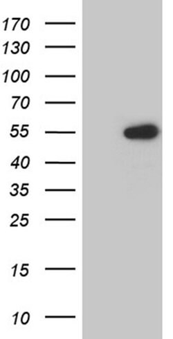 LSM11 Monoclonal Antibody (OTI1A4), TrueMAB , OriGene 100 &mu;L; Unconjugated:Antibodies,