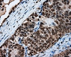 LTA4H Mouse anti-Human, Clone: OTI6B5, lyophilized, TrueMAB 100 &mu;g;