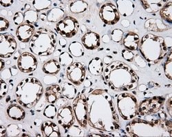 LTA4H Mouse anti-Human, Clone: OTI6B5, lyophilized, TrueMAB 100 &mu;g;