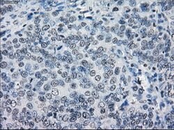LTA4H Mouse anti-Human, Clone: OTI2A9, lyophilized, TrueMAB 100 &mu;g;