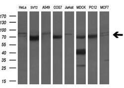 LTA4H Mouse anti-Human, Clone: OTI2C5, liquid, TrueMAB 100 &mu;L; Unconjugated:Antibodies,