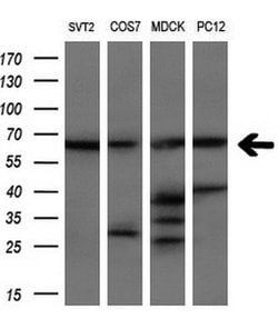 LTA4H Mouse anti-Human, Clone: OTI6B5, lyophilized, TrueMAB 100 &mu;g;