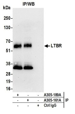 LTBR/Lymphotoxin-beta Receptor Rabbit anti-Human, Polyclonal, Bethyl Laboratories 100 &mu;L | Buy Online | Bethyl Laboratories, Inc | Fisher Scientific