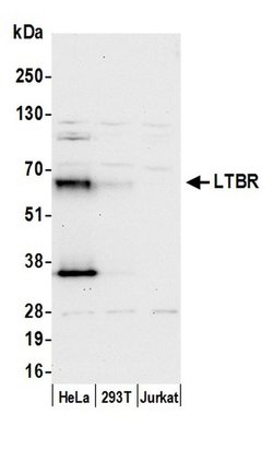 LTBR/Lymphotoxin-beta Receptor Rabbit anti-Human, Polyclonal, Bethyl Laboratories 100 &mu;L | Buy Online | Bethyl Laboratories, Inc | Fisher Scientific