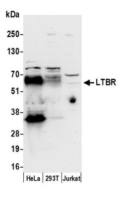 LTBR/Lymphotoxin-beta Receptor Rabbit anti-Human, Polyclonal, Bethyl Laboratories