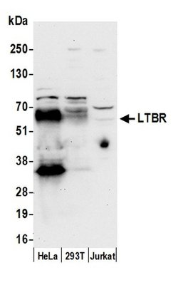 LTBR/Lymphotoxin-beta Receptor Polyclonal Antibody, Bethyl Laboratories:Antibodies:Primary