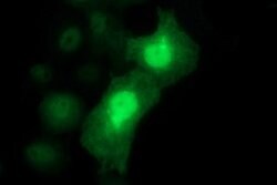 LYZ Mouse anti-Human, Clone: OTI2C2, lyophilized, TrueMAB 100 &mu;g; Unconjugated:Antibodies,