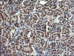 LYZ Mouse anti-Human, Clone: OTI1C9, lyophilized, TrueMAB 100 &mu;g; Unconjugated:Antibodies,