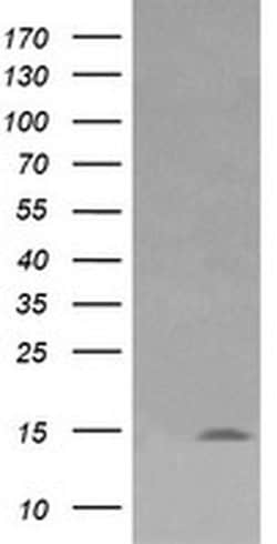 LYZ Monoclonal Antibody (OTI1D8), TrueMAB , OriGene 100 &mu;L; Unconjugated:Antibodies,