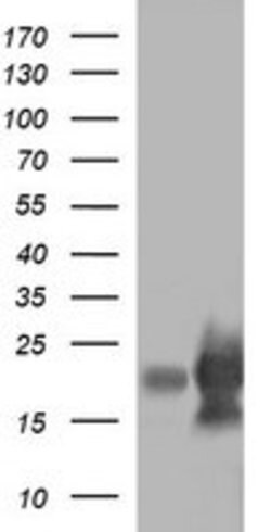 LYZ Mouse anti-Human, Clone: OTI2C2, lyophilized, TrueMAB 100 &mu;g; Unconjugated:Antibodies,