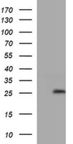 LZIC Monoclonal Antibody (OTI4F9), TrueMAB , OriGene:Antibodies:Primary