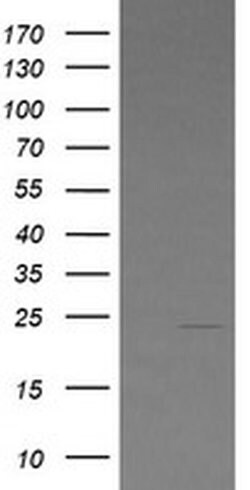 LZIC Monoclonal Antibody (OTI4E6), TrueMAB , OriGene 100 &mu;L; Unconjugated:Antibodies,