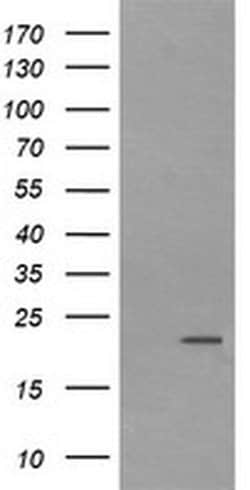 LZIC Monoclonal Antibody (OTI5F1), TrueMAB , OriGene:Antibodies:Primary