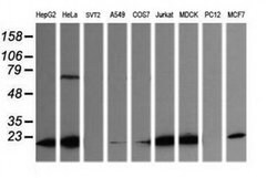 LZIC Monoclonal Antibody (OTI5F1), TrueMAB , OriGene 100 &mu;L; Unconjugated:Antibodies,