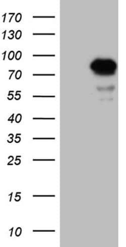 LZTS1 Monoclonal Antibody (OTI3D12), TrueMAB , OriGene:Antibodies:Primary