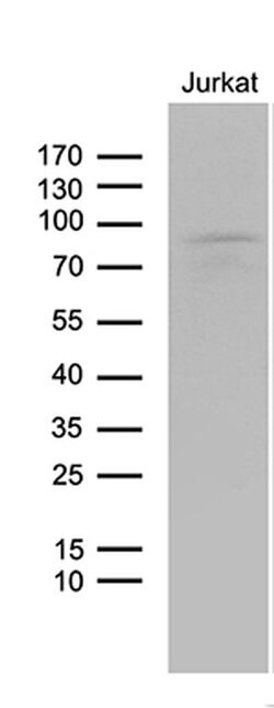 LZTS1 Monoclonal Antibody (OTI3D12), TrueMAB , OriGene:Antibodies:Primary