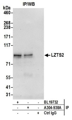 LZTS2 Rabbit anti-Human, Polyclonal, Bethyl Laboratories 10 &mu;l; Unlabeled:Antibodies,