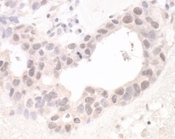 Lasu1/Ureb1 Rabbit anti-Human, Polyclonal, Bethyl Laboratories 100 &mu;L;
